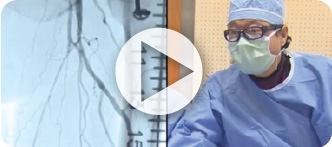 In this video, Dr. Park demonstrates techniques to successfully cross a 20 cm SFA CTO.